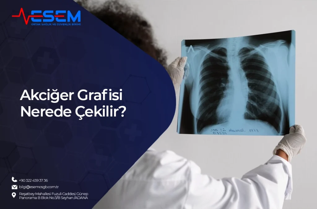 Akciğer Grafisi Nerede Çekilir?