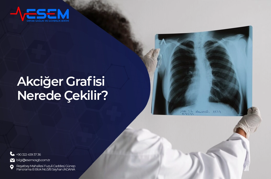 Akciğer Grafisi Nerede Çekilir?