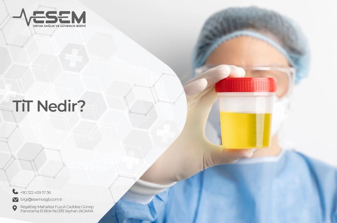 TiT Nedir?